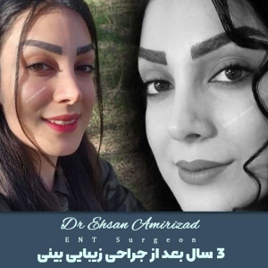 جراحی-بینی-19