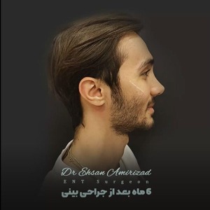 جراحی-بینی-28
