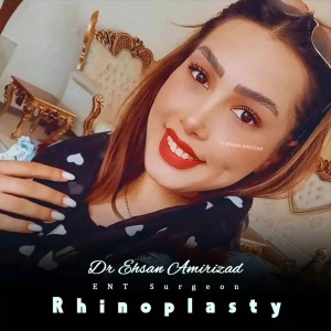 rhinoplasty-36
