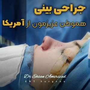 rhinoplasty-45