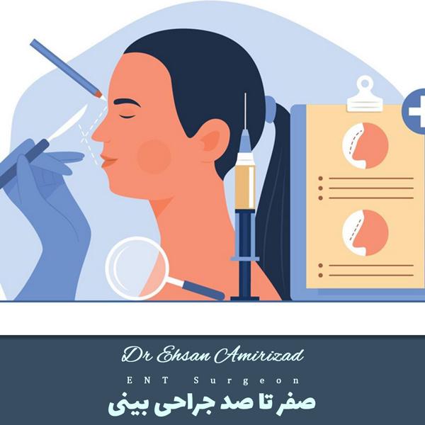 جراحی بینی - دکتر احسان امیری زاد