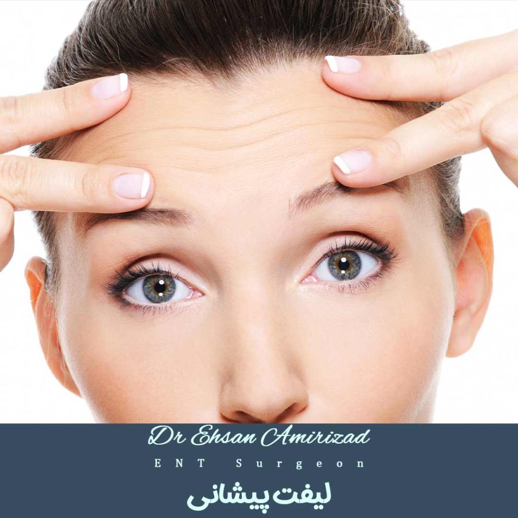 لیفت پیشانی - دکتر احسان امیری زاد