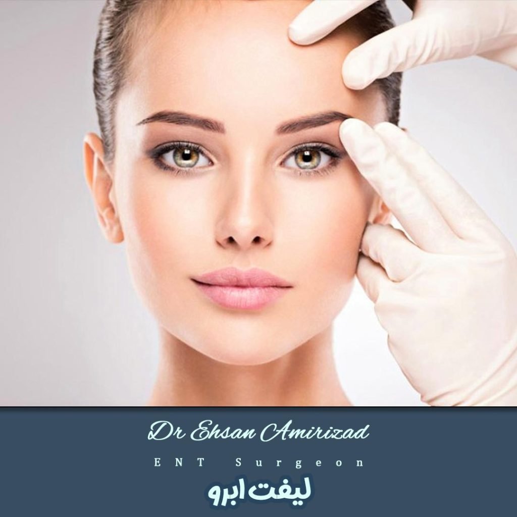 لیفت ابرو - دکتر احسان امیری زاد