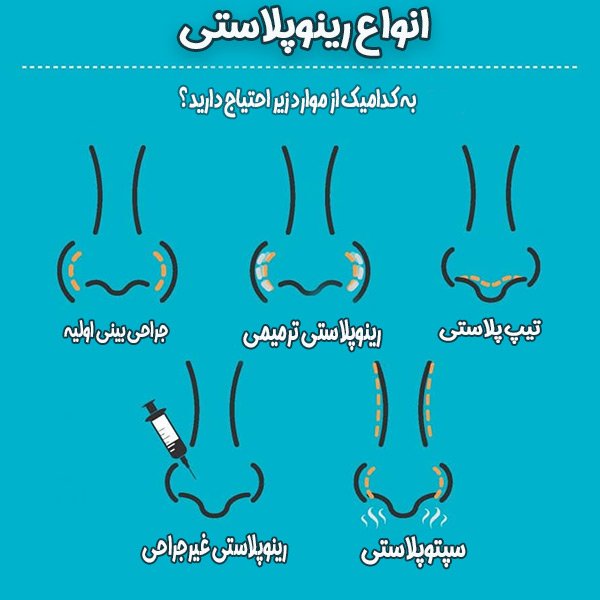 جراحی بینی - دکتر احسان امیری زاد