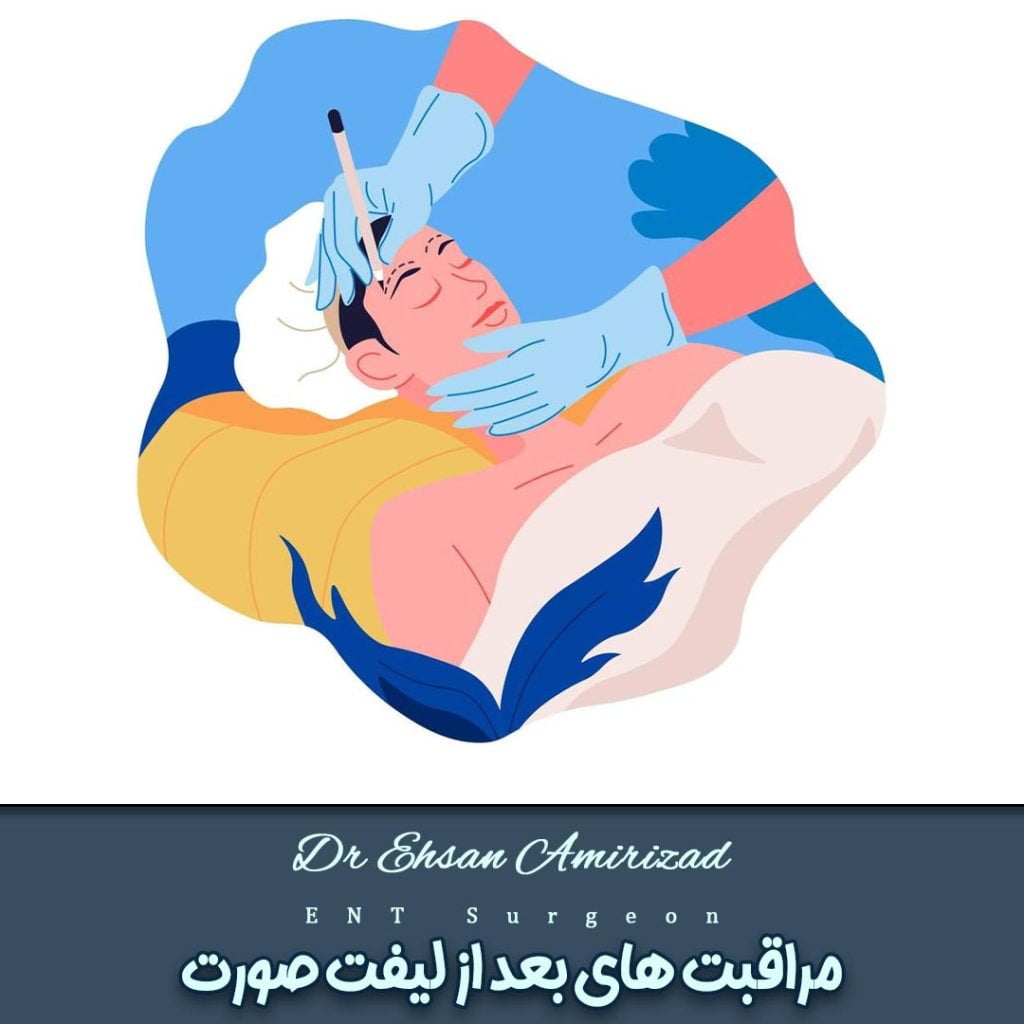 مراقبت های بعد از لیفت صورت-دکتر احسان امیری زاد