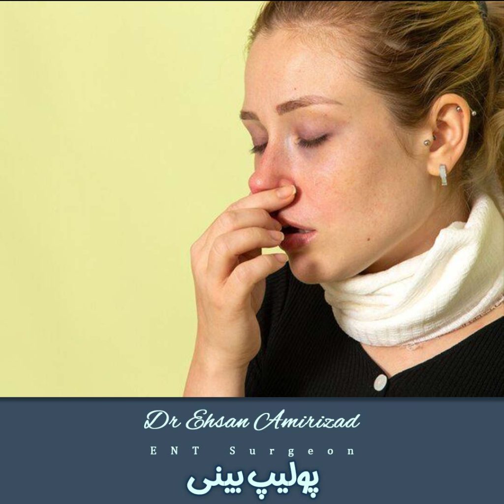 پولیپ بینی - دکتر احسان امیری زاد