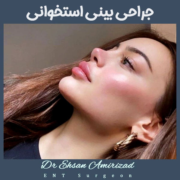 جراحی بینی استخوانی با دکتر امیری زاد در تهران