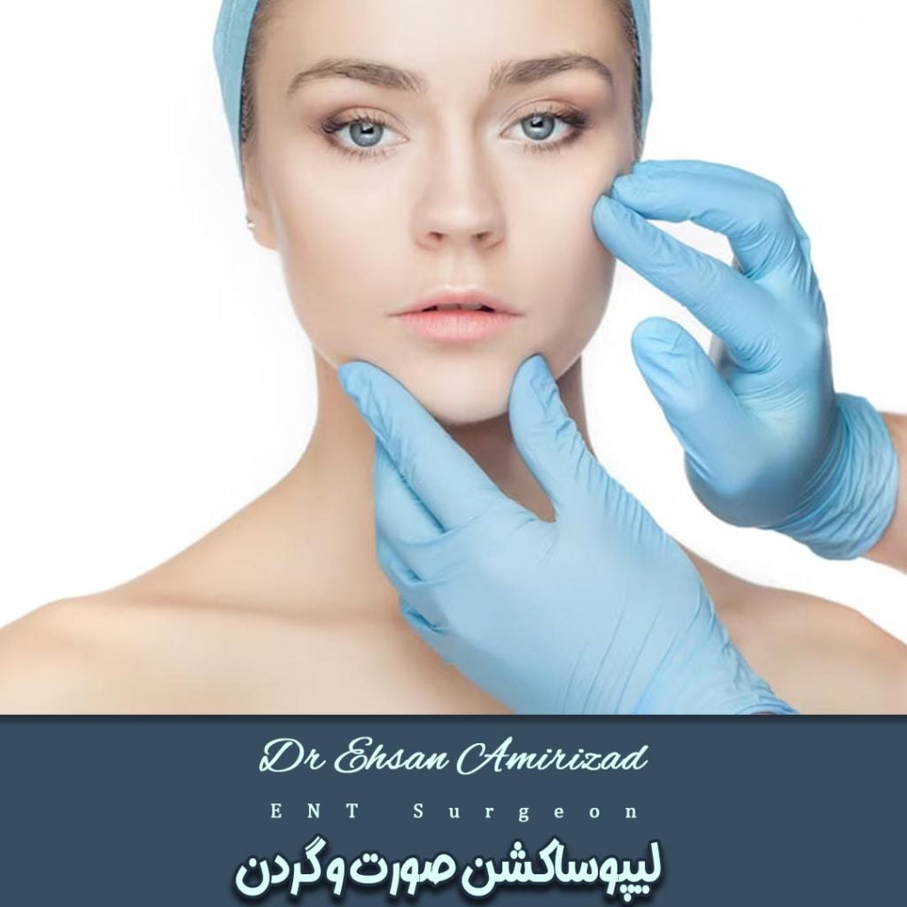 لیپوساکشن صورت و گردن-دکتر احسان امیری زاد