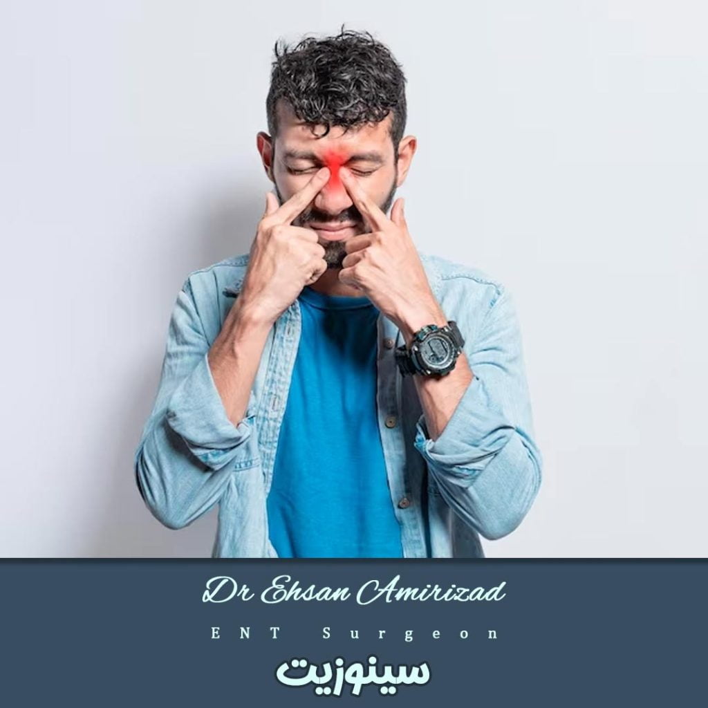 سینوزیت-دکتر احسان امیری زاد