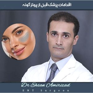 اقدامات دکتر امیری زاد قبل از پروتز گونه