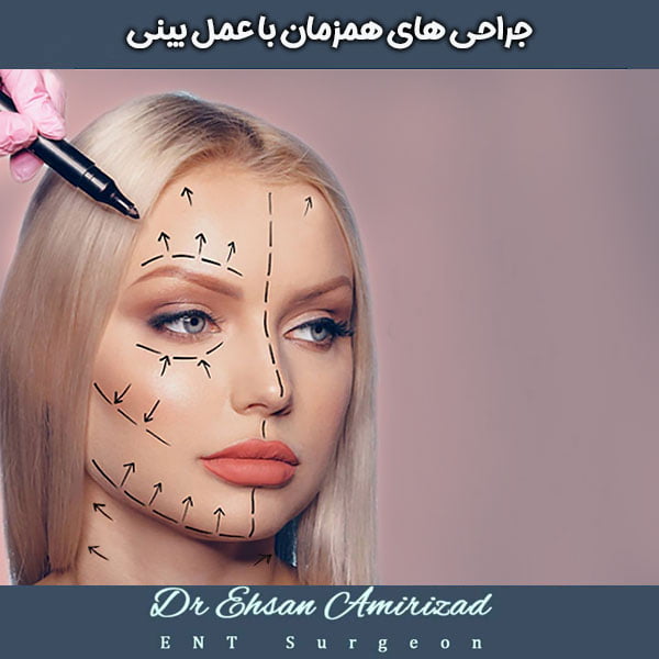combining rhinoplasty with other surgeries