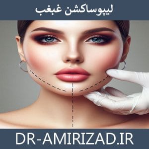 لیپوساکشن غبغب | دکتر امیری زاد
