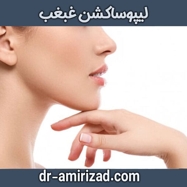 لیپوساکشن غبغب دکتر امیری زاد در تهران