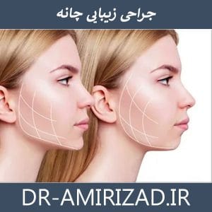 جراحی زیبایی چانه | دکتر امیری زاد