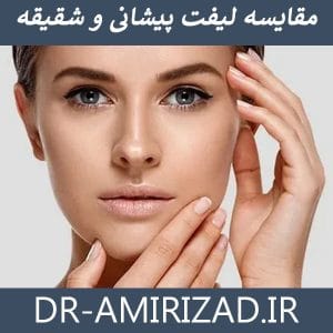 مقایسه لیفت پیشانی و شقیقه | دکتر احسان امیری زاد