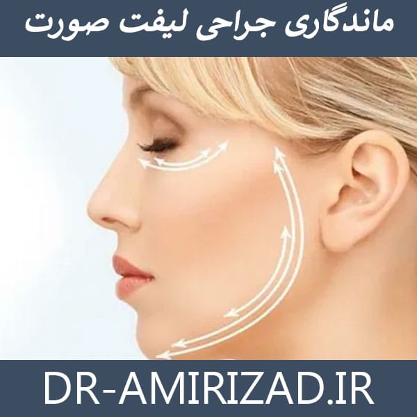 ماندگاری جراحی لیفت صورت | دکتر احسان امیری زاد