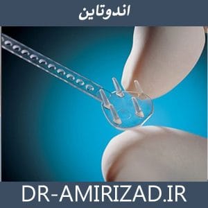 چنگک های اندوتاین - دکتر امیری زاد 