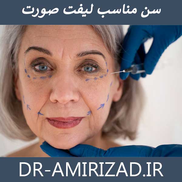 سن مناسب لیفت صورت - دکتر امیری زاد جراح لیفت 
