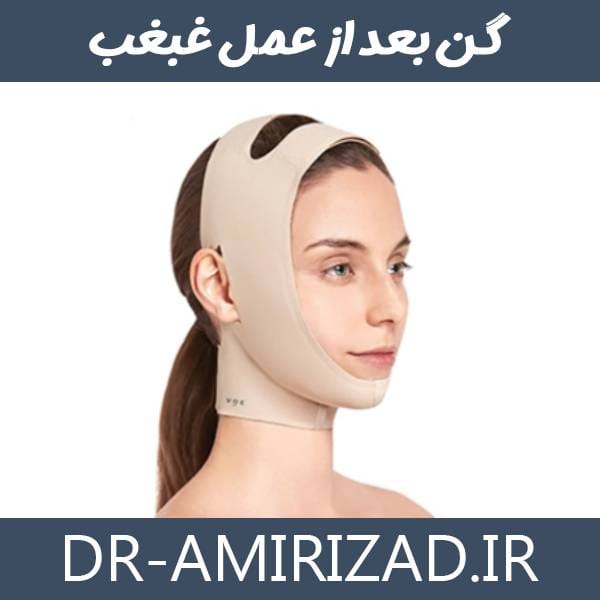 گن بعد از عمل غبغب