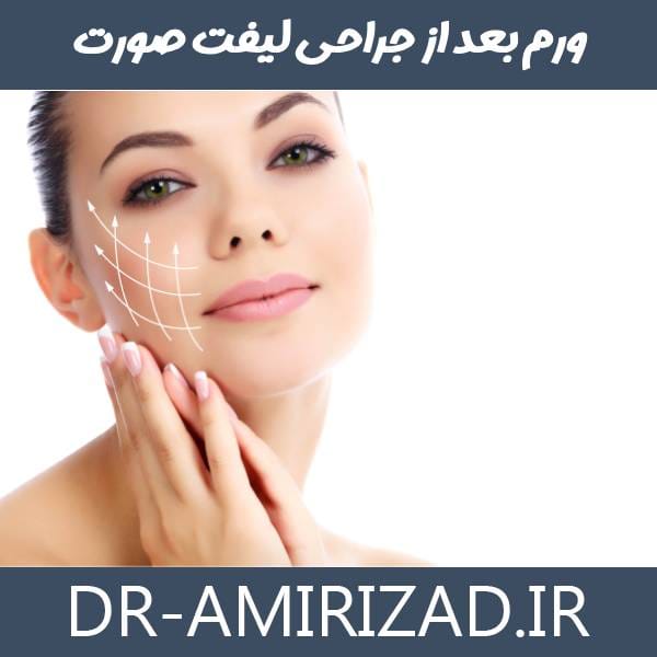 ورم بعد از جراحی لیفت صورت