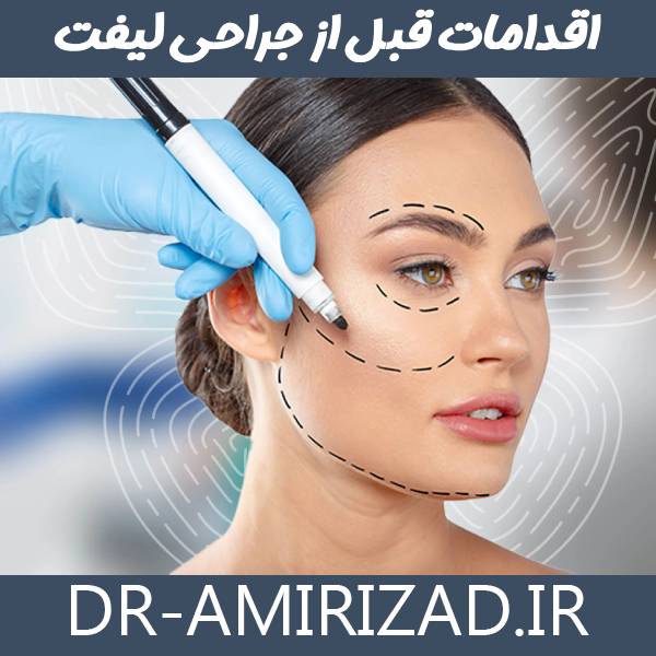 اقدامات قبل از لیفت صورت