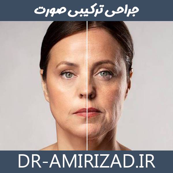 جراحی ترکیبی صورت