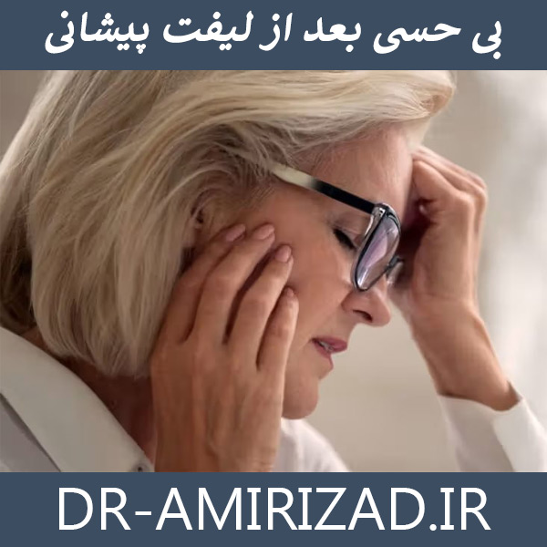 بی حسی بعد از لیفت پیشانی